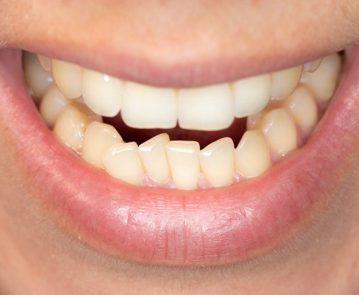 A close-up of a man’s crooked smile