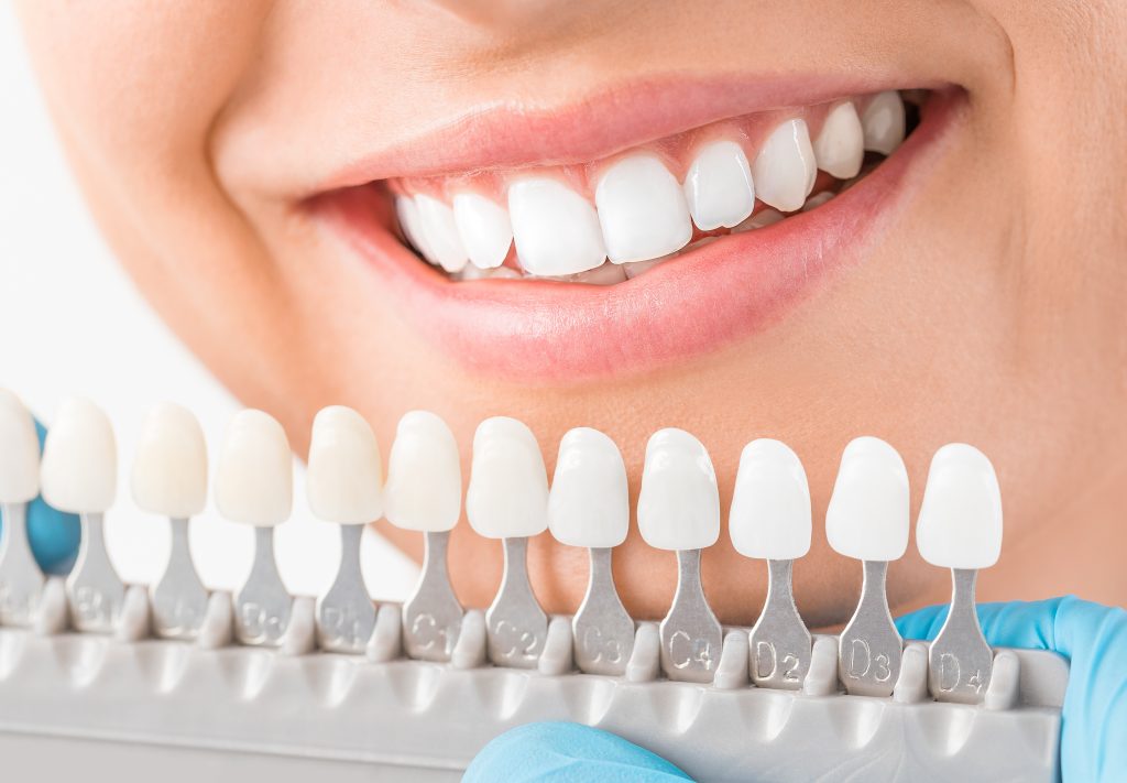 How Much Does Cosmetic Dentistry Cost Uk